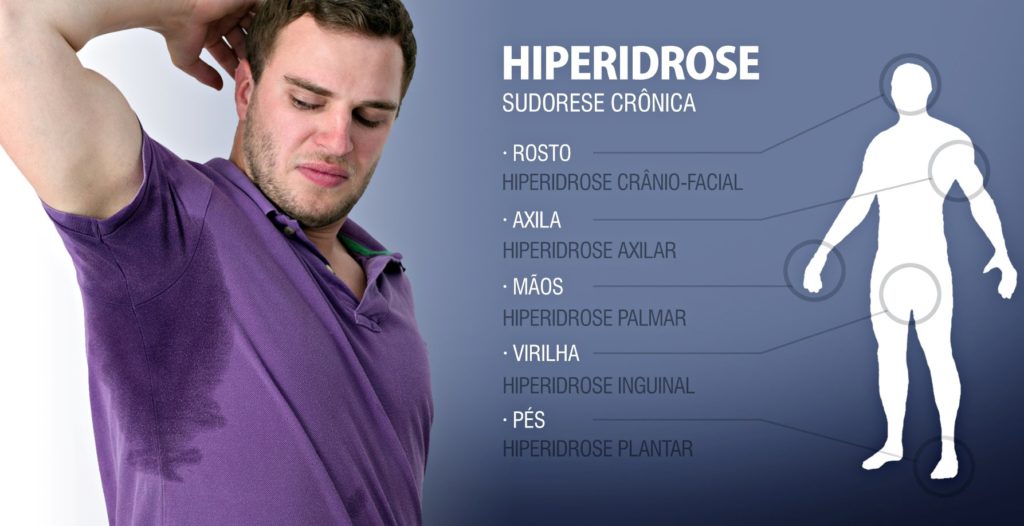 Conheça os tipos de Hiperidrose